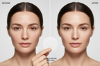 Western woman before and after using Medicube Zero Pore Pad showing refined pores and brighter skin
