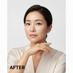 IOPE Retinol Super Bounce Serum 30ml - firm clear glowing skin after retinol serum use AFTER
Korean AFTER 1
