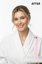 MEDICUBE Mini Booster Pro AFTER – Western model with visibly lifted firmer radiant skin after microcurrent beauty device treatment
